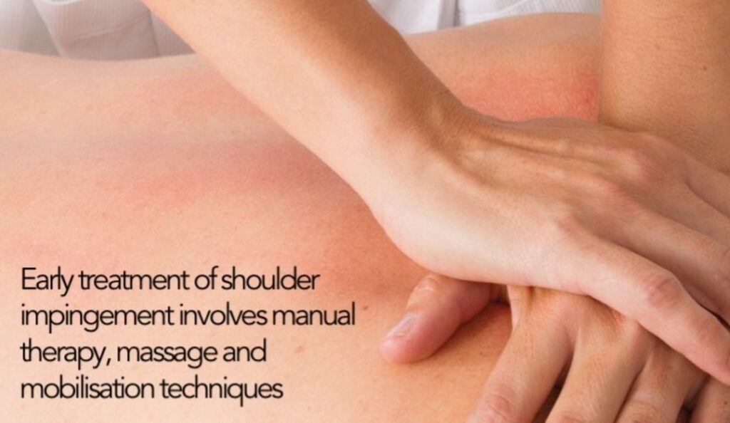 Early treatment of shoulder impingement 1080x627 1