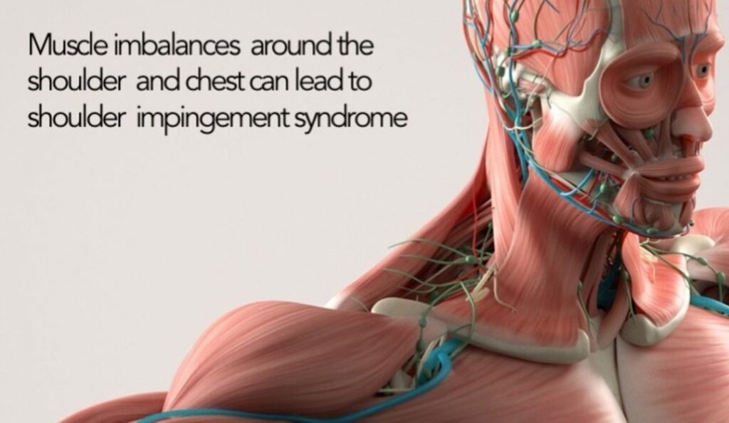 Muscle Imbalance 1080x627 1