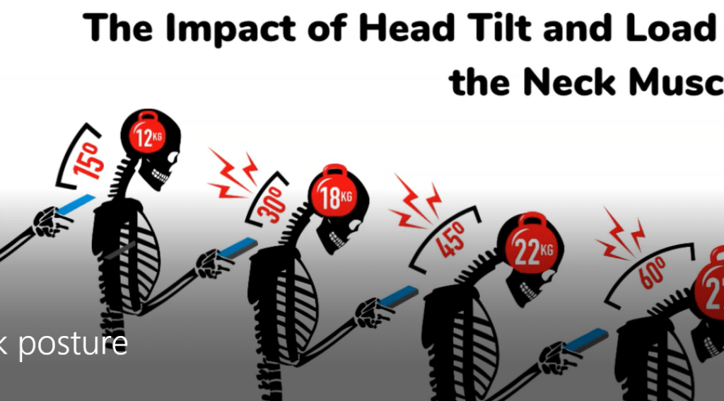 Head and neck posture - Metro Physio