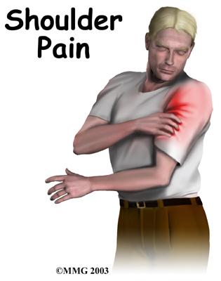 ShoulderPain